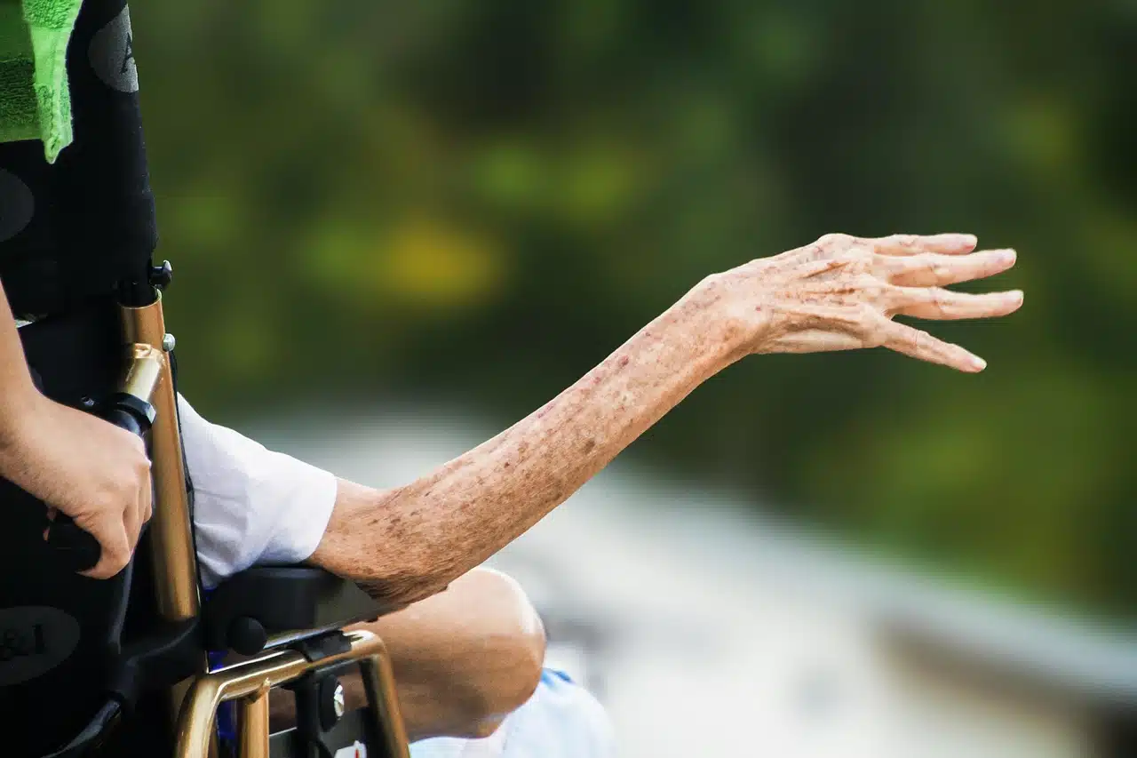 A wrinkled arm extending outside of a wheelchair